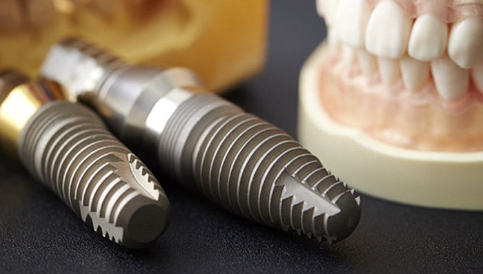 Русские импланты