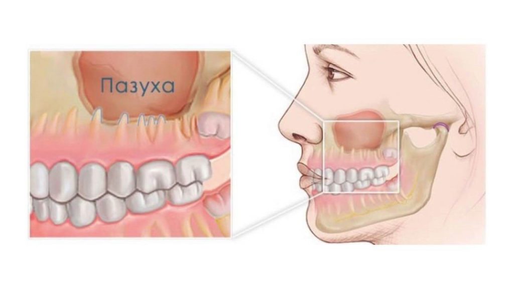 Боли в ушах и болят зубы