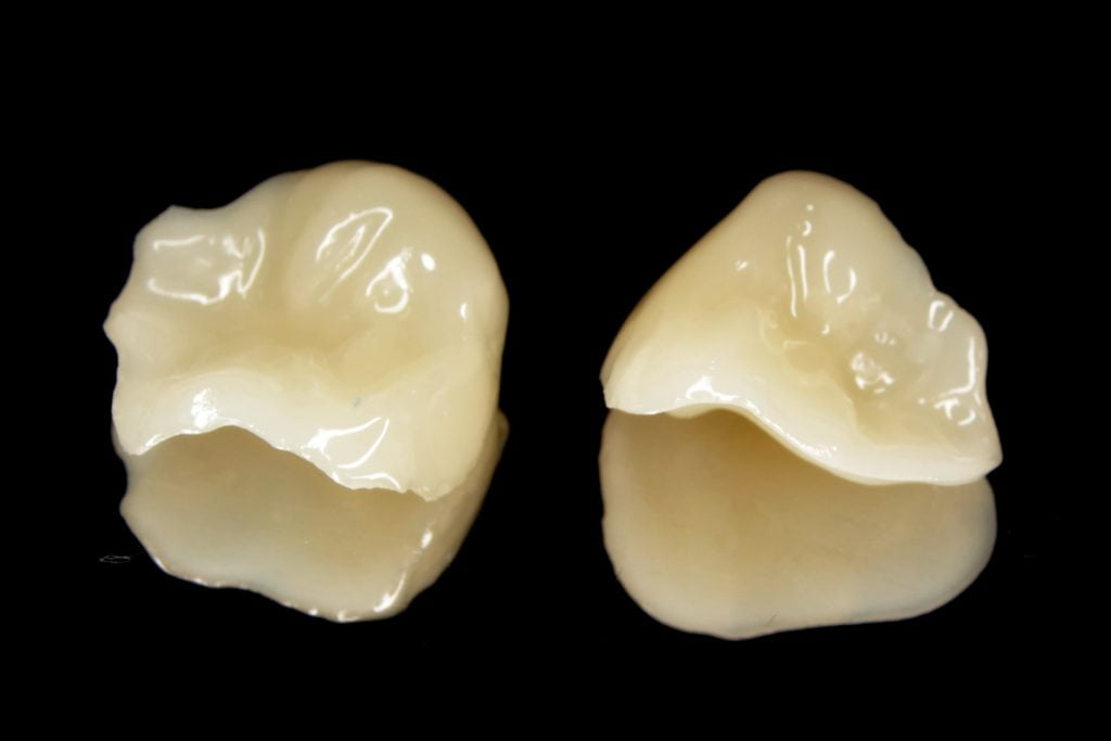 несъемные зубные протезы