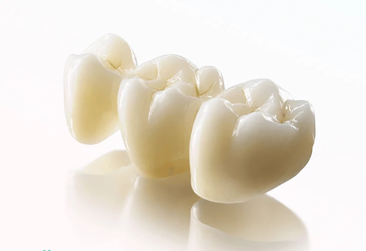 Циркониевая коронка