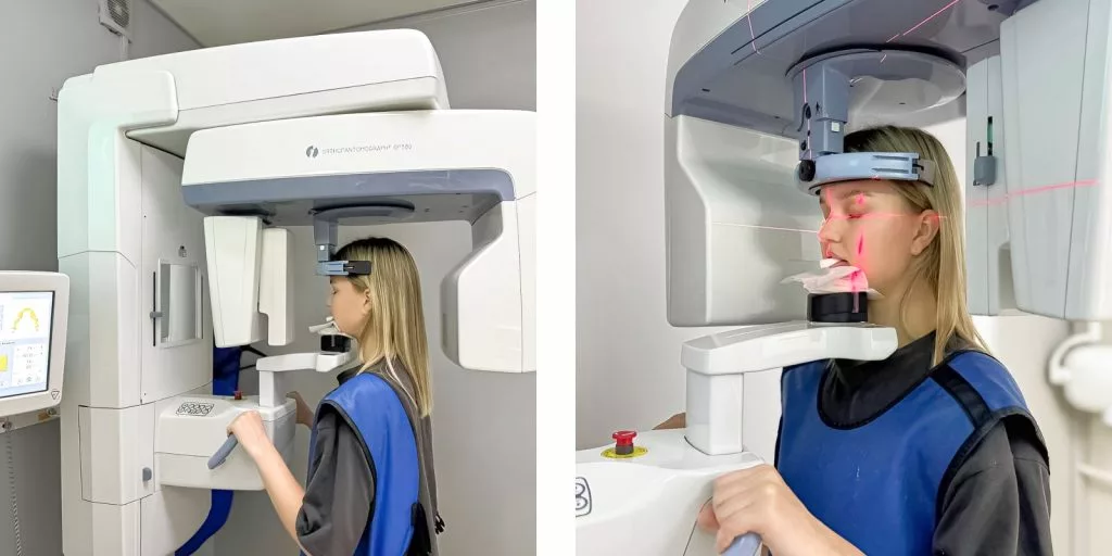 сколько каналов в зубах