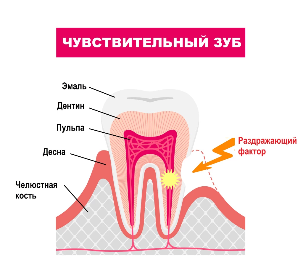 почему от сладкого болят зубы