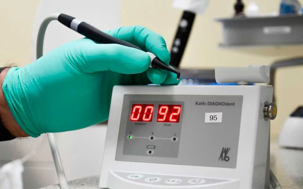 лечение корня зуба