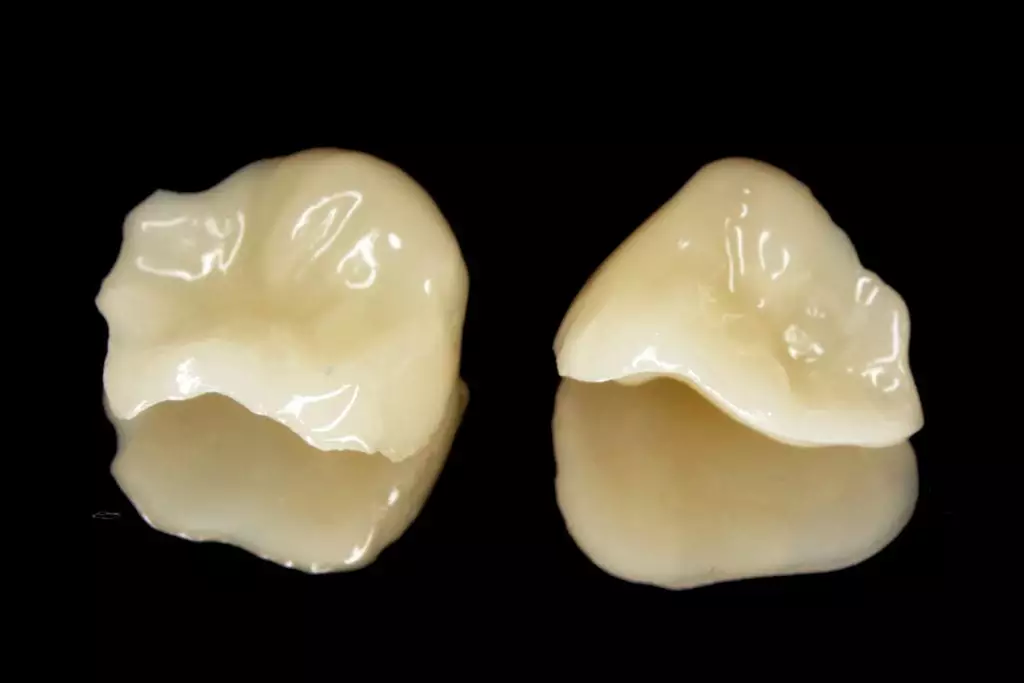 несъемные зубные протезы